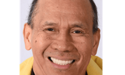 After treatment - Complete Dentures