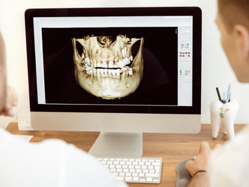 CBCT Cone Beam Technology